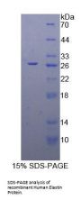 Human Elastin (ELN) Protein