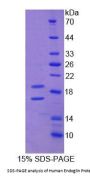 Human Endoglin / CD105 (ENG) Protein
