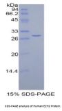 Human Enhancer Of Zeste Homolog 2 (EZH2) Protein