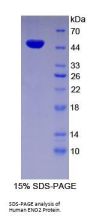 Human Enolase, Neuron Specific (NSE) Protein