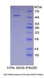 Human Enolase, Neuron Specific (NSE) Protein