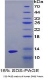 Human Enolase, Non Neuronal (NNE) Protein
