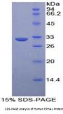 Human Ephrin Type A Receptor 1 (EPHA1) Protein