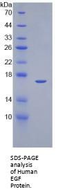 Human Epidermal Growth Factor (EGF) Protein