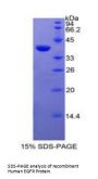 Human Epidermal Growth Factor Receptor (EGFR) Protein
