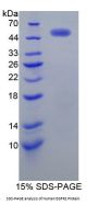 Human Receptor Tyrosine-Protein Kinase ErbB-2 (ERBB2) Protein