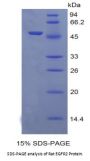 Rat Receptor Tyrosine-Protein Kinase ErbB-2 (ERBB2) Protein