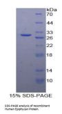 Human Epiphycan (EPYC) Protein