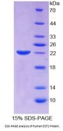 Human Epithelial Cell Transforming Sequence 2 (ECT2) Protein