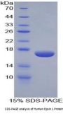 Human Epsin 1 (EPN1) Protein