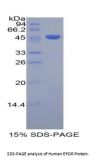 Human Erythropoietin Receptor (EPOR) Protein