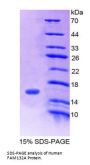 Human Family With Sequence Similarity 132, Member A (FAM132A) Protein