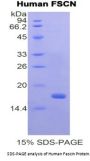 Human Fascin (FSCN) Protein