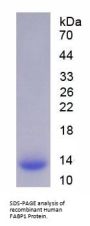 Human Fatty Acid Binding Protein 1, Liver (FABP1) Protein
