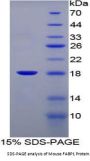 Mouse Fatty Acid Binding Protein 1, Liver (FABP1) Protein