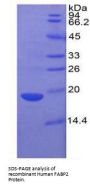 Human Fatty Acid-Binding Protein, Intestinal (FABP2) Protein