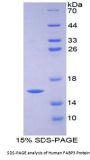 Human Fatty Acid Binding Protein 3, Muscle And Heart (FABP3) Protein