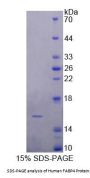 Human Fatty Acid Binding Protein 4, Adipocyte (FABP4) Protein