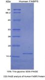 Human Fatty Acid Binding Protein 5, Epidermal (FABP5) Protein