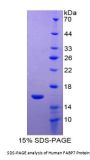 Human Fatty Acid Binding Protein 7, Brain (FABP7) Protein