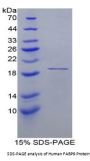 Human Fatty Acid Binding Protein 9, Testis (FABP9) Protein