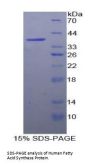 Human Fatty Acid Synthase (FASN) Protein