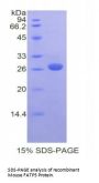 Mouse Bile Acyl-CoA Synthetase (SLC27A5) Protein