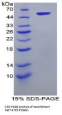 Rat Bile Acyl-CoA Synthetase (SLC27A5) Protein