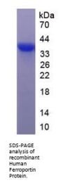 Human Ferroportin / FPN (SLC40A1) Protein