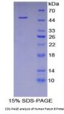 Human Fetuin B (FETUB) Protein