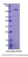 Human Fibrinogen Beta (FGB) Protein