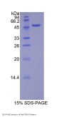 Rat Fibroblast Growth Factor 10 (FGF10) Protein
