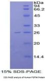 Human Fibroblast Growth Factor Receptor 4 (FGFR4) Protein