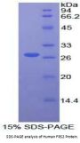 Human Fibroblast Growth Factor Receptor Substrate 2 (FRS2) Protein