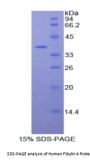 Human Fibulin 4 (FBLN4) Protein