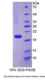 Human Fibulin 5 (FBLN5) Protein