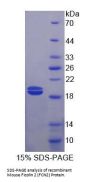 Mouse Ficolin 2 (FCN2) Protein