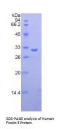 Human Ficolin 3 (FCN3) Protein