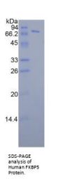 Human FK506 Binding Protein 5 (FKBP5) Protein
