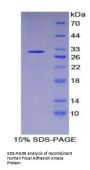 Human Focal Adhesion Kinase (FAK) Protein