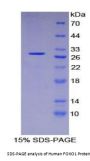 Human Forkhead Box Protein O1 (FOXO1) Protein