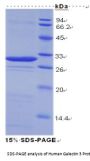 Human Galectin 3 (LGALS3) Protein