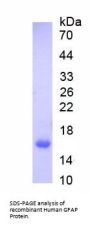 Human Glial Fibrillary Acidic Protein (GFAP) Protein