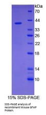 Mouse Glial Fibrillary Acidic Protein (GFAP) Protein