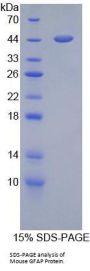 Mouse Glial Fibrillary Acidic Protein (GFAP) Protein