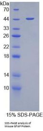 Mouse Glial Fibrillary Acidic Protein (GFAP) Protein
