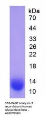 Human Glucosidase Beta, Acid (GbA) Protein