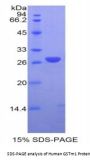 Human Glutathione S Transferase Mu 1 (GSTm1) Protein