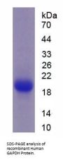Human Glyceraldehyde-3-Phosphate Dehydrogenase (GAPDH) Protein