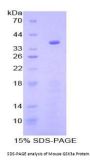 Mouse Glycogen Synthase Kinase 3 Alpha (GSK3a) Protein